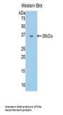 Cadherin, Epithelial (CDHE) Antibody