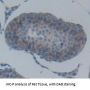 Cadherin, Epithelial (CDHE) Antibody