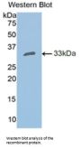 Carbonic Anhydrase II (CA2) Antibody