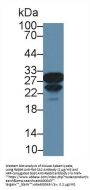 Carbonic Anhydrase II (CA2) Antibody