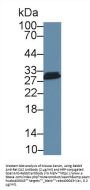 Carbonic Anhydrase II (CA2) Antibody