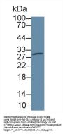 Carbonic Anhydrase II (CA2) Antibody