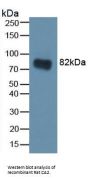 Carbonic Anhydrase II (CA2) Antibody