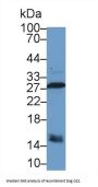 Carbonic Anhydrase II (CA2) Antibody