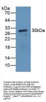 Carbonic Anhydrase II (CA2) Antibody