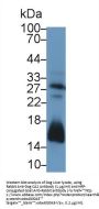 Carbonic Anhydrase II (CA2) Antibody