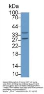 Carbonic Anhydrase II (CA2) Antibody