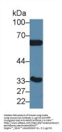 Carbonic Anhydrase IV (CA4) Antibody