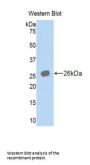 Carbonic Anhydrase IV (CA4) Antibody