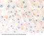 Collagen Type XVIII Alpha 1 (COL18A1) Antibody