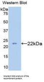Collagen Type XVIII Antibody