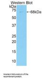 Collagen Type XVIII Alpha 1 (COL18A1) Antibody