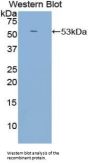 Complement Receptor 2 Antibody