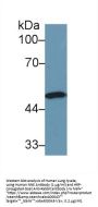 Enolase, Non Neuronal (NNE) Antibody