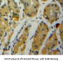 Enolase, Non Neuronal (NNE) Antibody
