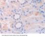 Interleukin 1 Delta (FIL1d) Antibody