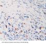 Interleukin 1 Delta (FIL1d) Antibody