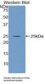 Nucleoporin 160 kDa (NUP160) Antibody