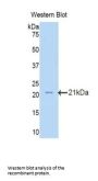 Oxidosqualene Cyclase (OSC) Antibody