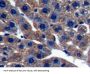 Oxidosqualene Cyclase (OSC) Antibody