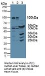Ribonuclease Inhibitor Antibody