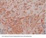 Ribonuclease Inhibitor Antibody