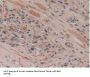 Ribonuclease Inhibitor Antibody
