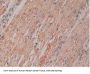 Ribonuclease Inhibitor Antibody