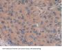 Ribonuclease Inhibitor Antibody