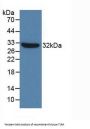 Toll Like Receptor 4 (TLR4) Antibody