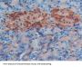 Toll Like Receptor 4 (TLR4) Antibody