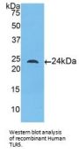 Toll Like Receptor 5 (TLR5) Antibody