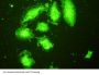 Toll Like Receptor 5 (TLR5) Antibody