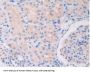 Toll Like Receptor 5 (TLR5) Antibody