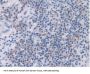 Toll Like Receptor 5 (TLR5) Antibody