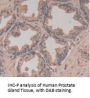Toll Like Receptor 5 (TLR5) Antibody