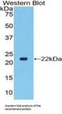 Toll Like Receptor 7 (TLR7) Antibody