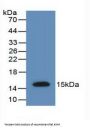 Muellerian-Inhibiting Factor (AMH) Antibody