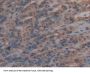 Muellerian-Inhibiting Factor (AMH) Antibody
