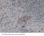 Muellerian-Inhibiting Factor (AMH) Antibody
