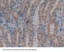 Muellerian-Inhibiting Factor (AMH) Antibody