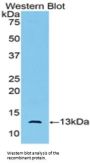 Muellerian-Inhibiting Factor (AMH) Antibody