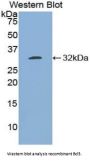 B-Cell CLL/Lymphoma 3 (Bcl3) Antibody
