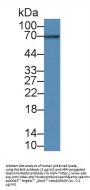 B-Cell CLL/Lymphoma 3 (Bcl3) Antibody