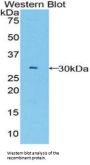 B-Cell CLL/Lymphoma 3 (Bcl3) Antibody