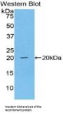 Centromere Protein E (CENPE) Antibody