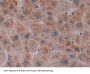 Centromere Protein E (CENPE) Antibody