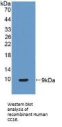 Uteroglobin (SCGB1A1) Antibody