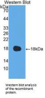 Coagulation Factor VIII Antibody