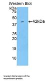 Creatine Kinase B-Type (CKB) Antibody
